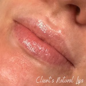 Client's natural lips