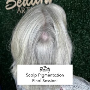 Example of scalp pigmentation final session
